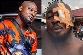 Ghana Police Komot Funny Face's Left Eye With Serious Beatings